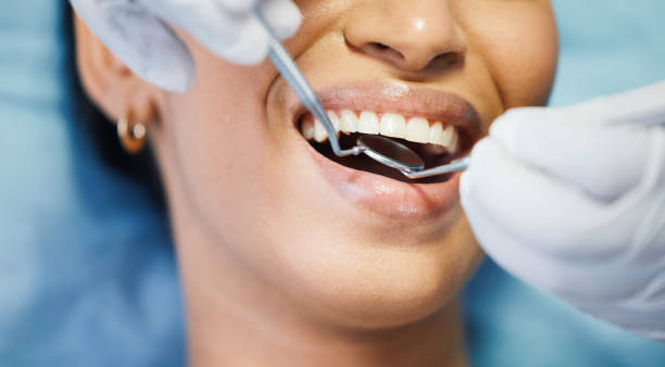 Best Emergency Tooth Extraction in Jacksonville, OR